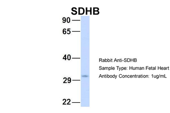 SDHB Rabbit Polyclonal Antibody