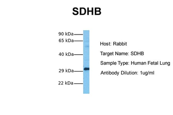 SDHB Rabbit Polyclonal Antibody