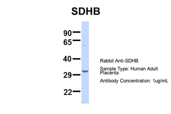 SDHB Rabbit Polyclonal Antibody