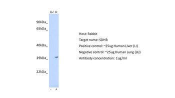 SDHB Rabbit Polyclonal Antibody
