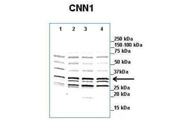 CNN1 Rabbit Polyclonal Antibody