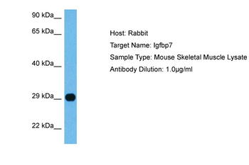 IGFBP7 Rabbit Polyclonal Antibody