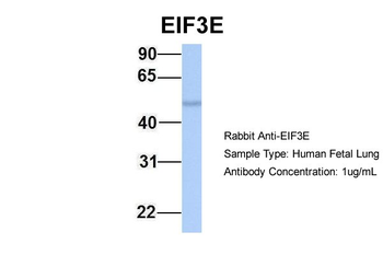 EIF3E Rabbit Polyclonal Antibody