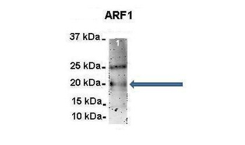 ARF1 Rabbit Polyclonal Antibody