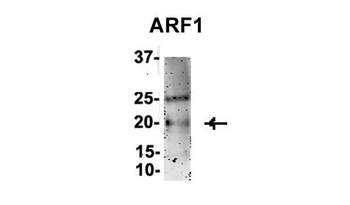 ARF1 Rabbit Polyclonal Antibody