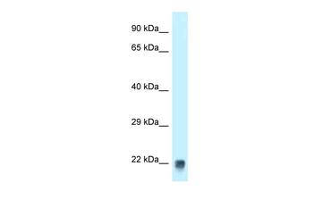 Tagln Rabbit Polyclonal Antibody