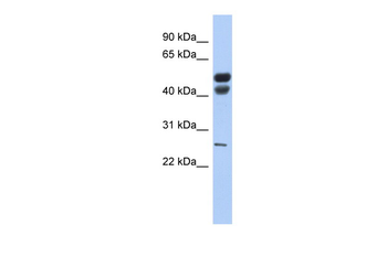 LIPF Rabbit Polyclonal Antibody