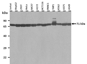 HSPA8 Rabbit Polyclonal Antibody