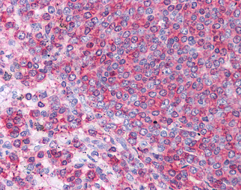 HSPA8 Rabbit Polyclonal Antibody