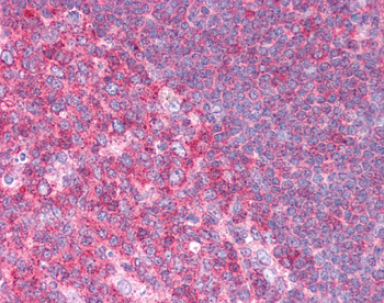 HSPA8 Rabbit Polyclonal Antibody