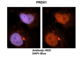PRDX1 Rabbit Polyclonal Antibody