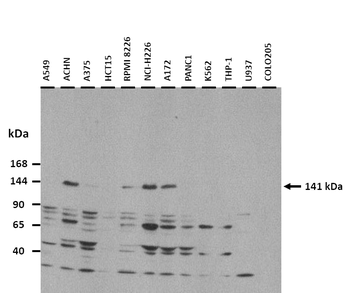MTR Rabbit Polyclonal Antibody