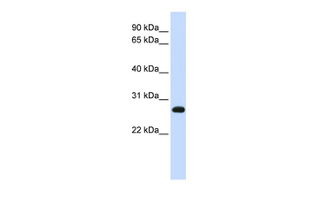 SNAP23 Rabbit Polyclonal Antibody
