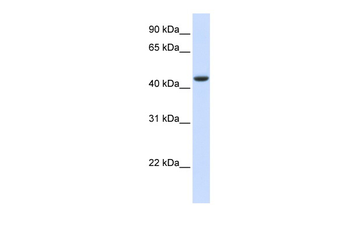 TRDMT1 Rabbit Polyclonal Antibody