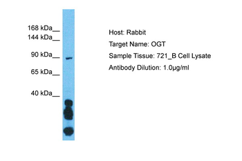 OGT Rabbit Polyclonal Antibody