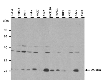 TREM2 Rabbit Polyclonal Antibody