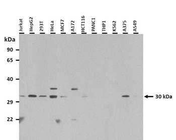 SRPRB Rabbit Polyclonal Antibody