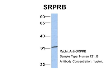 SRPRB Rabbit Polyclonal Antibody