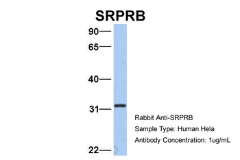 SRPRB Rabbit Polyclonal Antibody