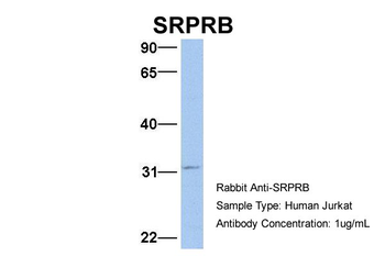 SRPRB Rabbit Polyclonal Antibody
