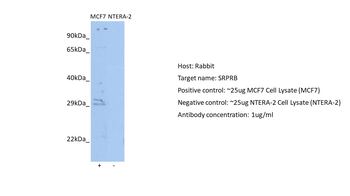 SRPRB Rabbit Polyclonal Antibody