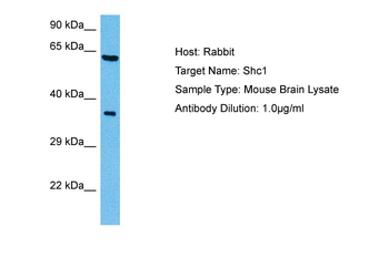 SHC1 Rabbit Polyclonal Antibody