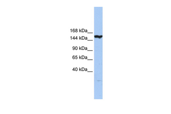 CASP8AP2 Rabbit Polyclonal Antibody