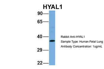 HYAL1 Rabbit Polyclonal Antibody