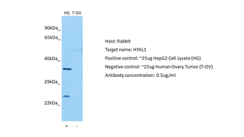 HYAL1 Rabbit Polyclonal Antibody