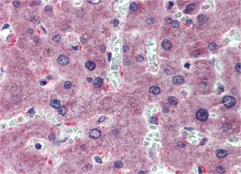 HYAL1 Rabbit Polyclonal Antibody