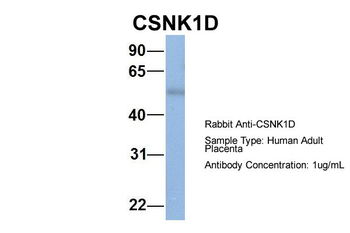 CSNK1D Rabbit Polyclonal Antibody