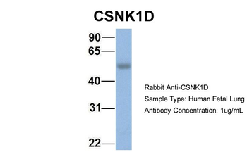CSNK1D Rabbit Polyclonal Antibody