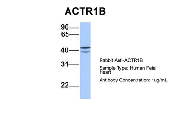 ACTR1B Rabbit Polyclonal Antibody