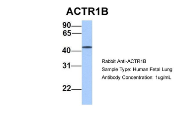 ACTR1B Rabbit Polyclonal Antibody