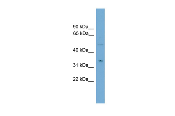 MGLL Rabbit Polyclonal Antibody