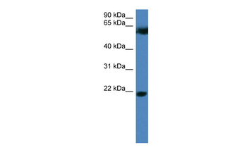FBXO32 Rabbit Polyclonal Antibody