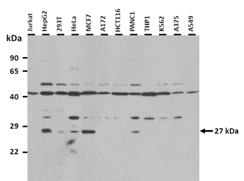 GSTM3 Rabbit Polyclonal Antibody
