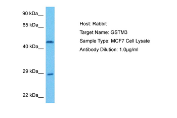 GSTM3 Rabbit Polyclonal Antibody