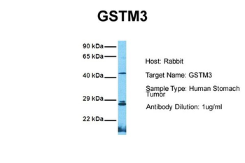 GSTM3 Rabbit Polyclonal Antibody