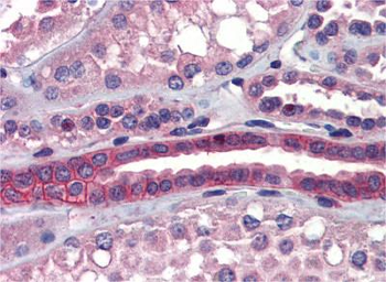 SSX2IP Rabbit Polyclonal Antibody