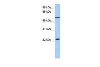 PIAS2 Rabbit Polyclonal Antibody