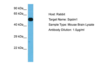 SQSTM1 Rabbit Polyclonal Antibody