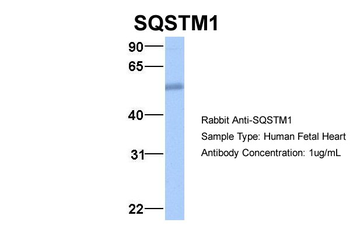 SQSTM1 Rabbit Polyclonal Antibody
