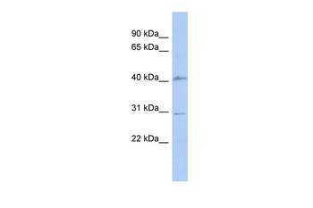 SQSTM1 Rabbit Polyclonal Antibody