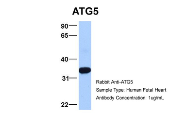 ATG5 Rabbit Polyclonal Antibody