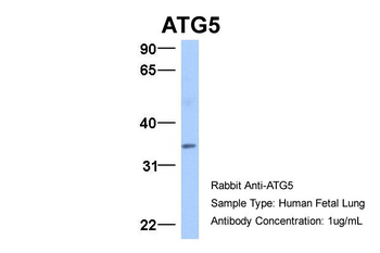 ATG5 Rabbit Polyclonal Antibody