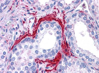 ATG5 Rabbit Polyclonal Antibody