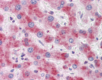 ATG16L1 Rabbit Polyclonal Antibody