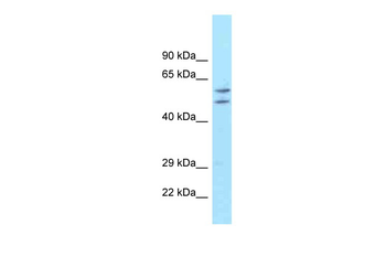 ATG16L1 Rabbit Polyclonal Antibody