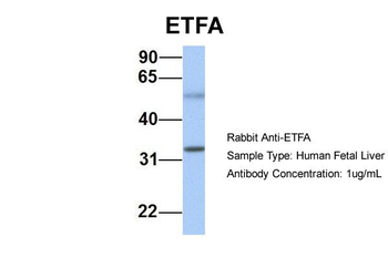 ETFA Rabbit Polyclonal Antibody